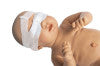 Fototherapie oogbeschermer Yota/Y-vorm (S/M/L) per 25 stuks